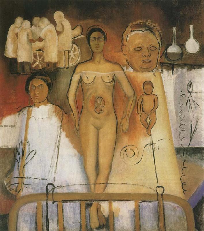Frida Kahlo Kahlo and Caesarean operation china oil painting image